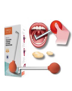 Tonsillstenar tonsilclin Ta bort tonsillstenar Vita bitar i halsen Tonsilloliter